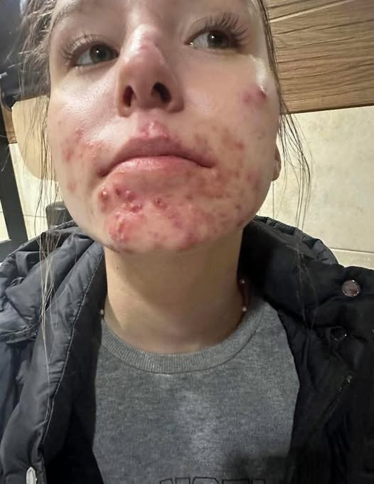 What He Thought Was an Allergy Turned Out to Be Something Else