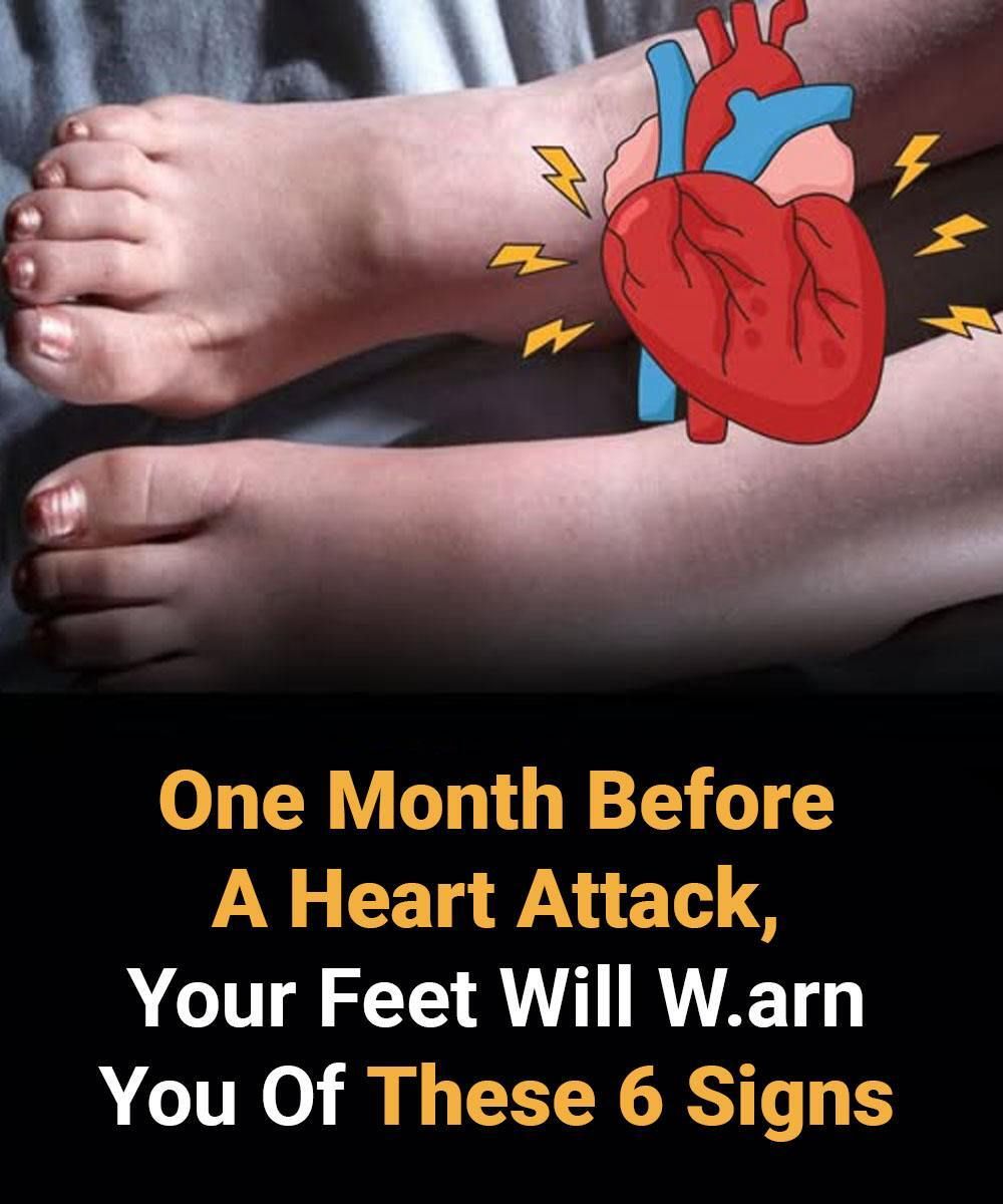 Your Feet Can Warn You About Heart Trouble—Here’s What to Look For