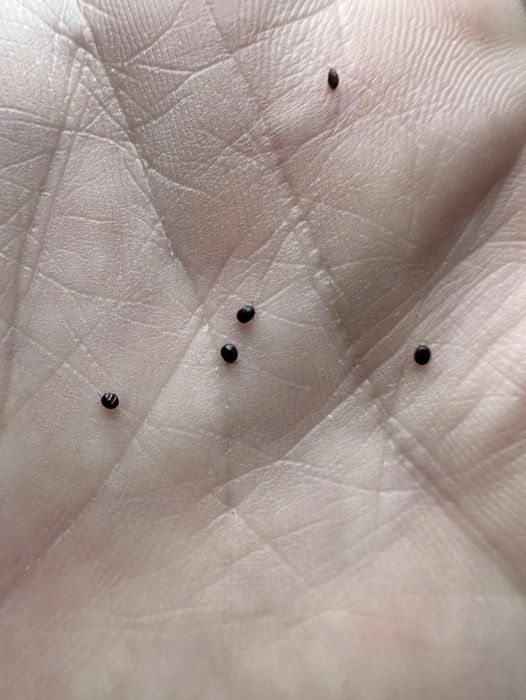 How to Remove and Prevent Ticks Safely — Protecting Your Family and Pets