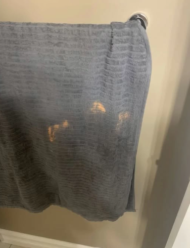 The Mystery of the Orange Towel Stains — and What They Really Mean
