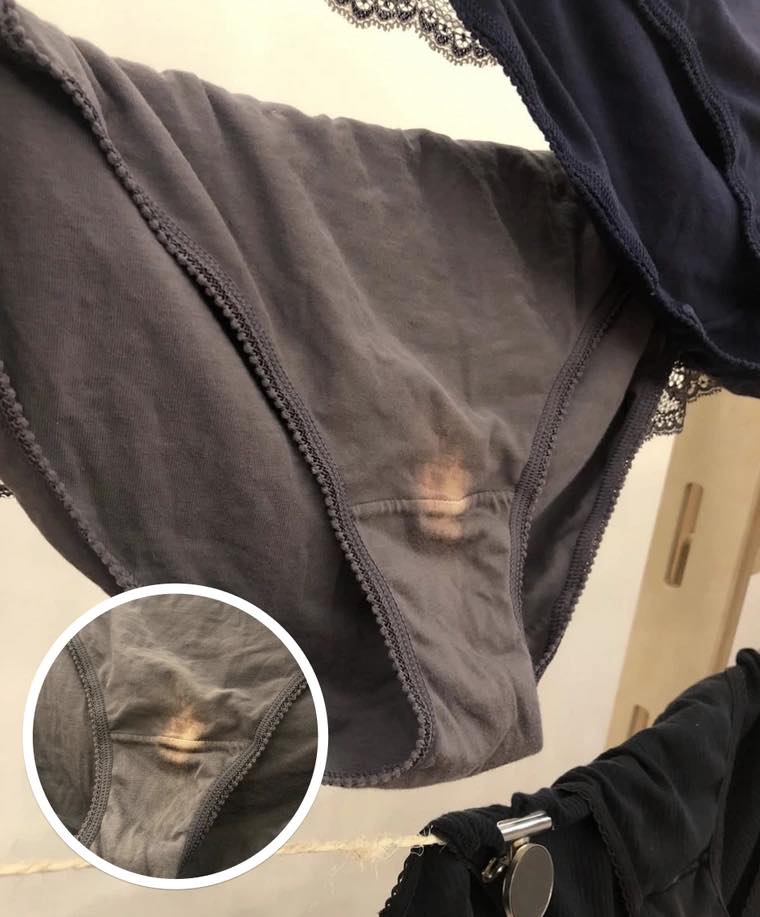 Why Light Patches Appear on Clothes After Washing
