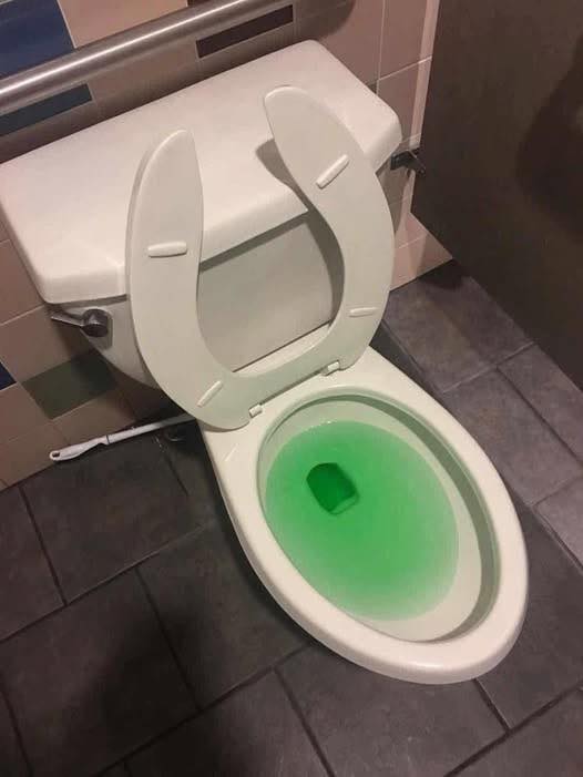 How to Handle a Minor Toilet Clog With Calm, Simple Solutions