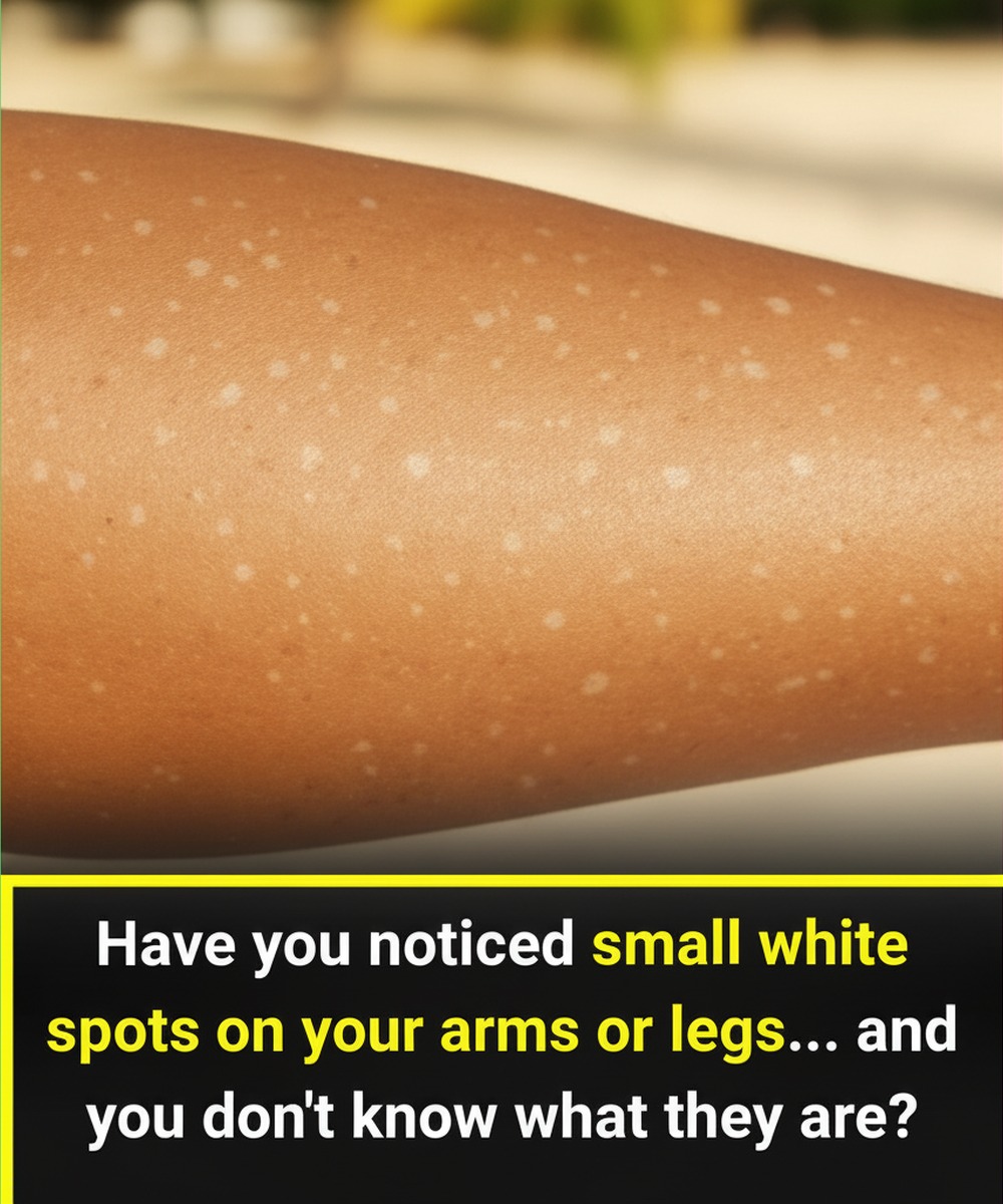 What White Spots on Your Skin May Reveal — And How Nutrition Plays a Role