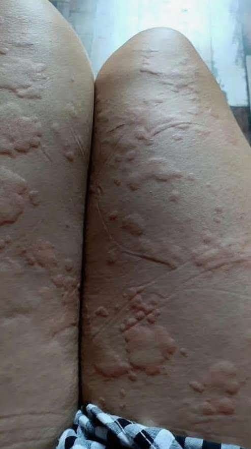 Understanding Genital Skin Changes: What to Know and How to Care for Your Body