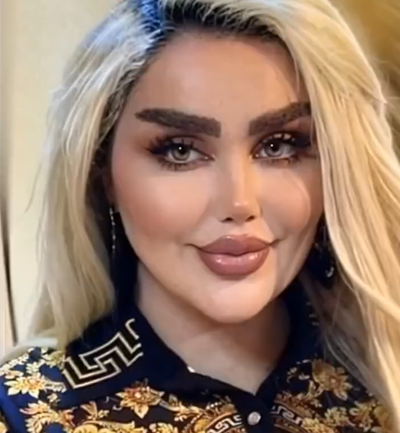 \Dalia Naeem’s Transformation Sparks Global Conversation About Beauty and Self-Expression