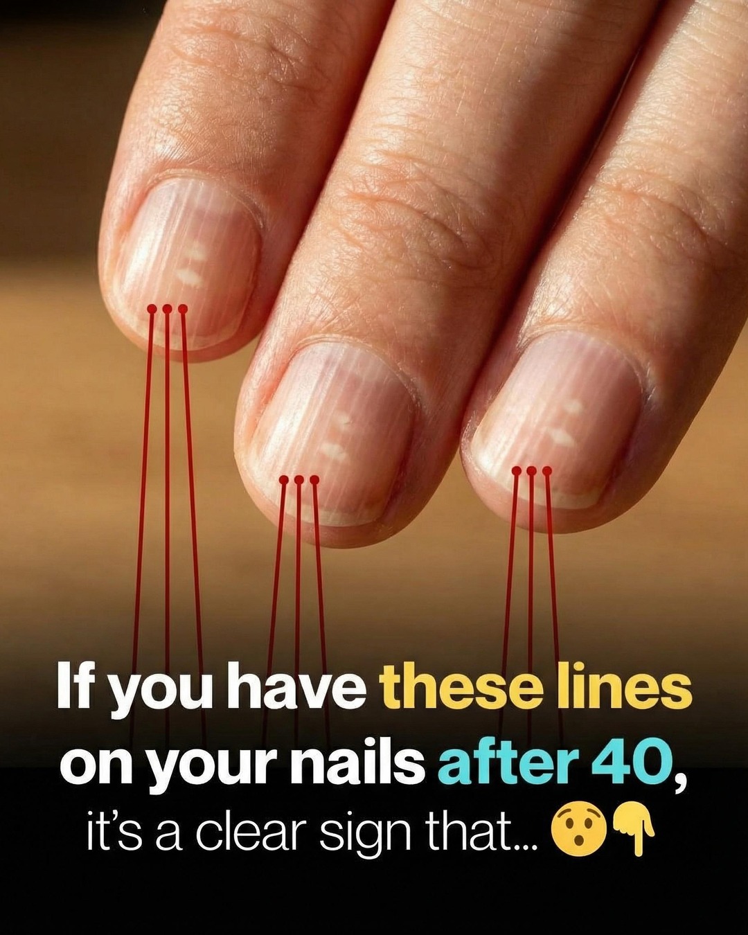 How to Understand and Care for Vertical Nail Ridges as You Age