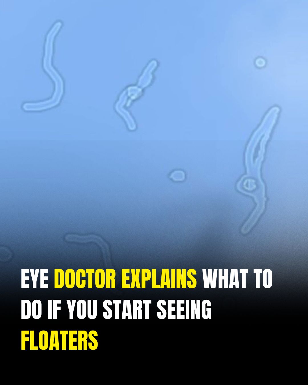 Eye Floaters: A Common Vision Change Most People Experience