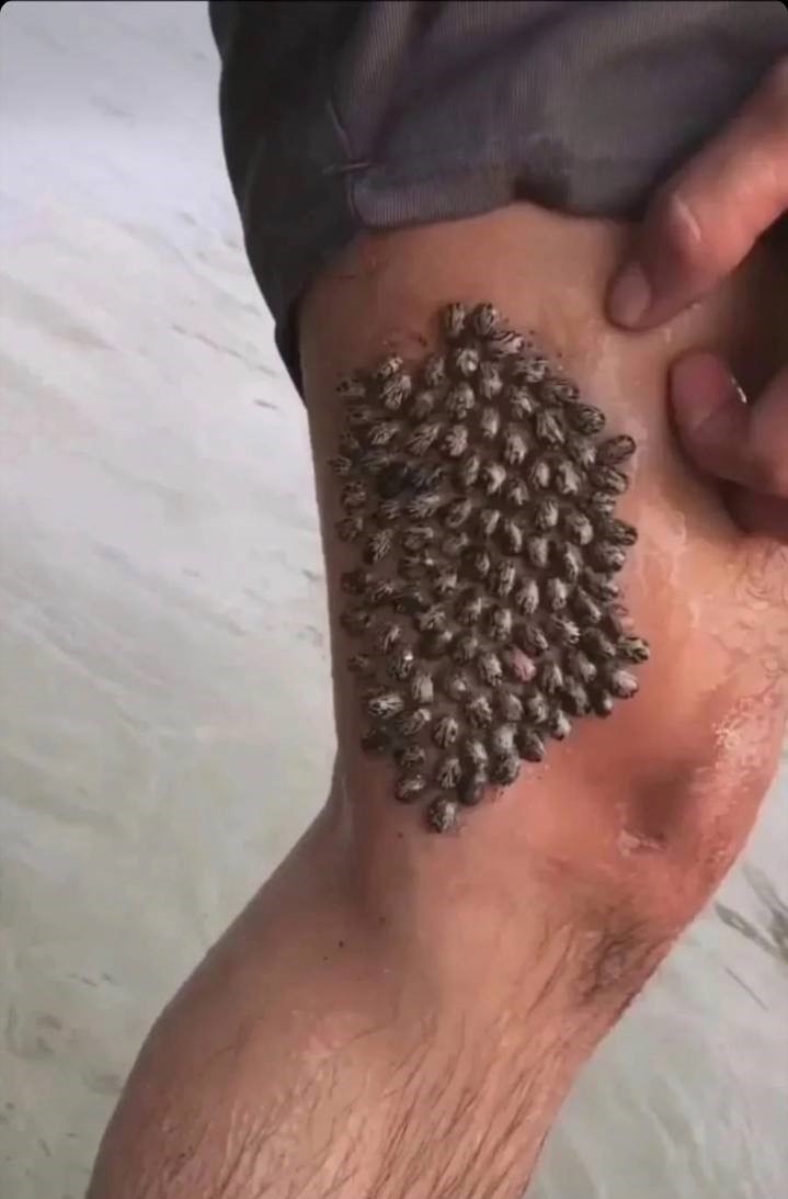 How to Care for Everyday Skin Changes on Your Legs Without Overcomplicating It