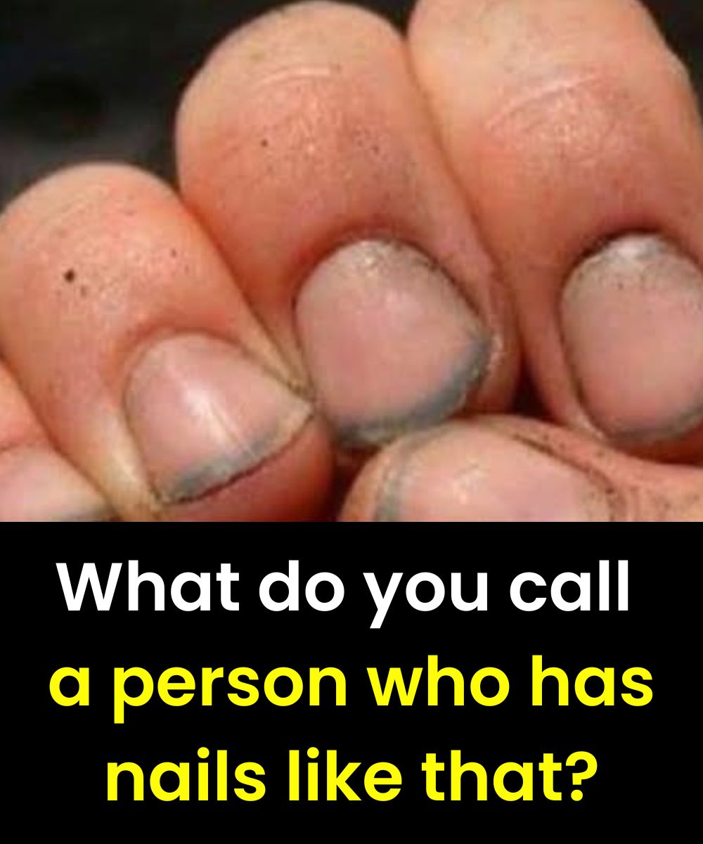 What Do Dirty Nails Really Say About a Person?
