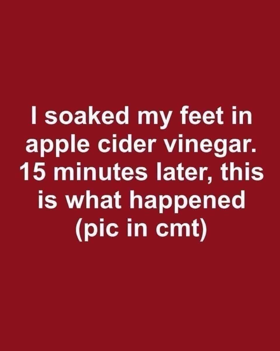 Apple Cider Vinegar for Dandruff: What It Can—and Can’t—Do