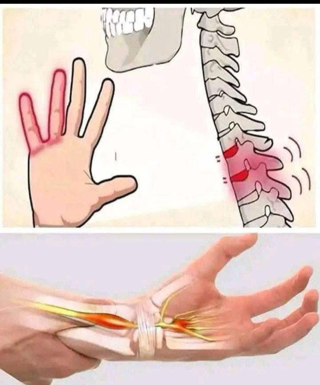 Why You May Be Waking Up With Tingling Hands