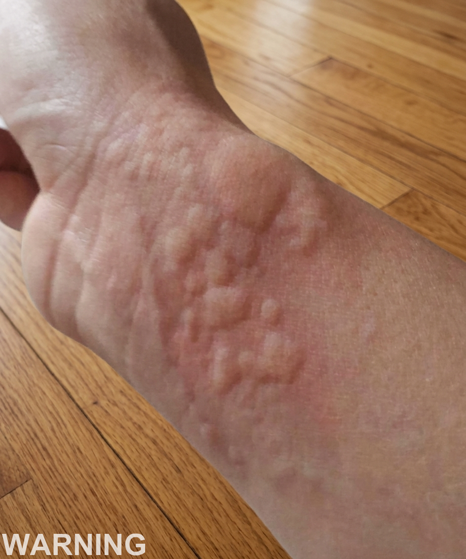 When a Rash Becomes an Emergency: Warning Signs You Should Never Ignore