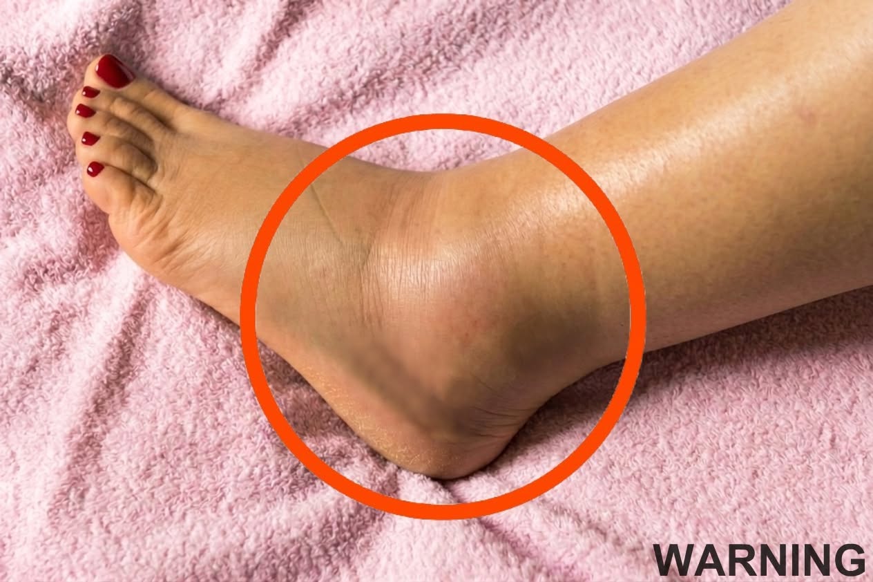 Swollen Feet Could Be an Early Warning Sign Older Adults Shouldn’t Ignore