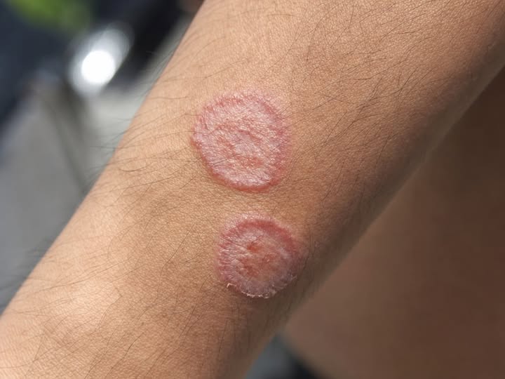 When Skin Symptoms May Signal More Than a Simple Irritation